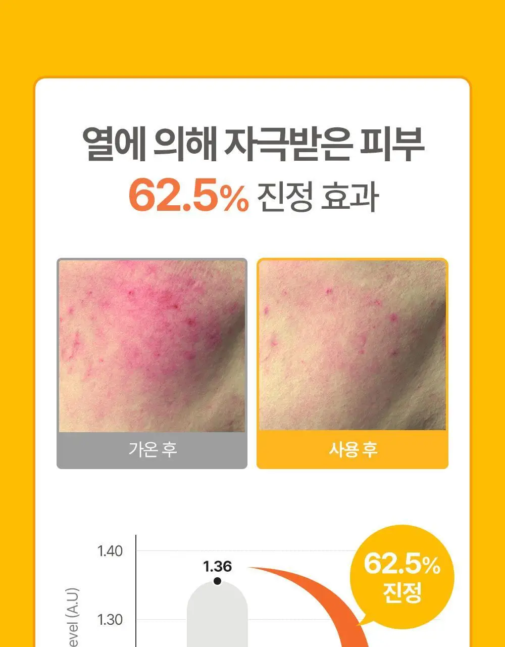 [만4~10세용] 아토팜 키즈 마스크팩 5매 3종 택1 상세페이지 59